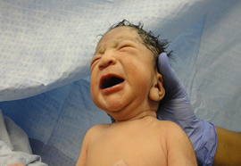 birth attendance image